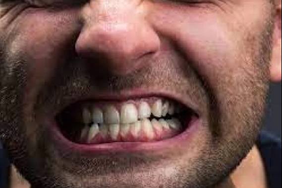 مشاكل الأسنان