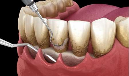 تنظيف الجير