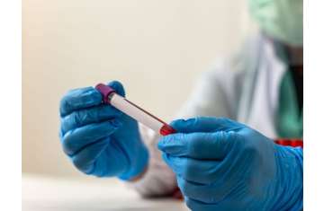 مركب فطري واعد ضد السرطان