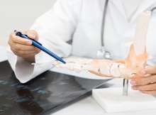 علماء روس يبتكرون براغي جراحية لربط كسور العظام المعقّدة