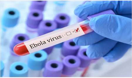 أمريكا تخصص 50 مليون دولار لتطوير علاجات مضادة لسلالات إيبولا