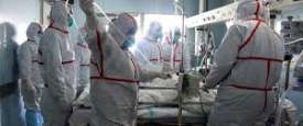 أطباء يعالجون مريض مصاب بفيروس H7N4