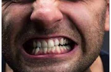 مشاكل الأسنان